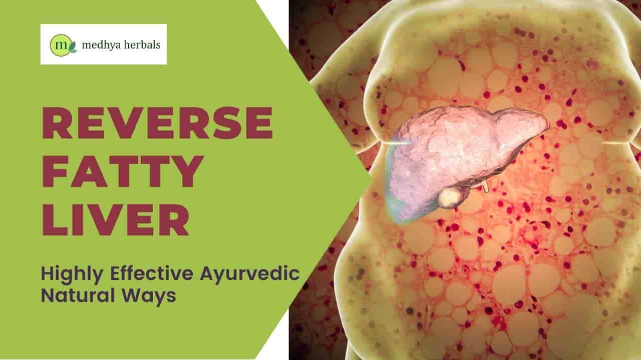 Reverse Fatty Liver Ayurvedic Treatment, Herbs, Yoga