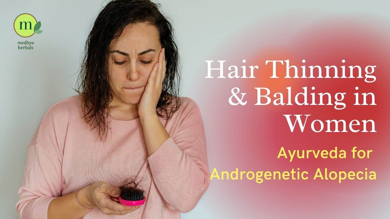 Androgenetic Alopecia - Hair Thinning- Balding in Women-min
