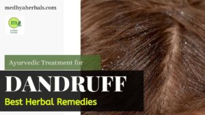Ayurvedic Treatment Herbal Remedies to Remove Dandruff