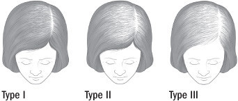 FPHL-Hair Loss in Women-Ludwig Scale