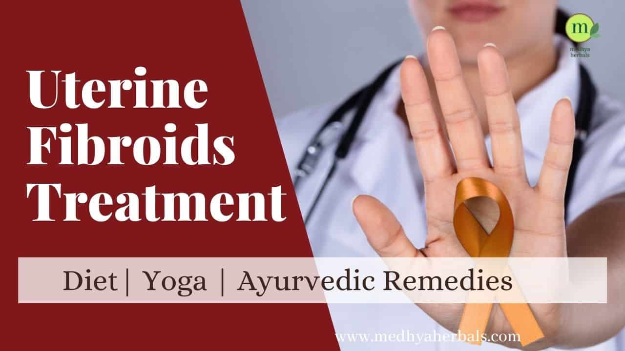 Uterine Fibroids Treatment Ayurveda-min