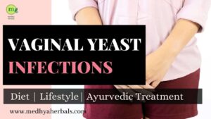 Vaginal Yeast Infections - Ayurvedic Treatment-Candida Vaginitis-Fungal Infections