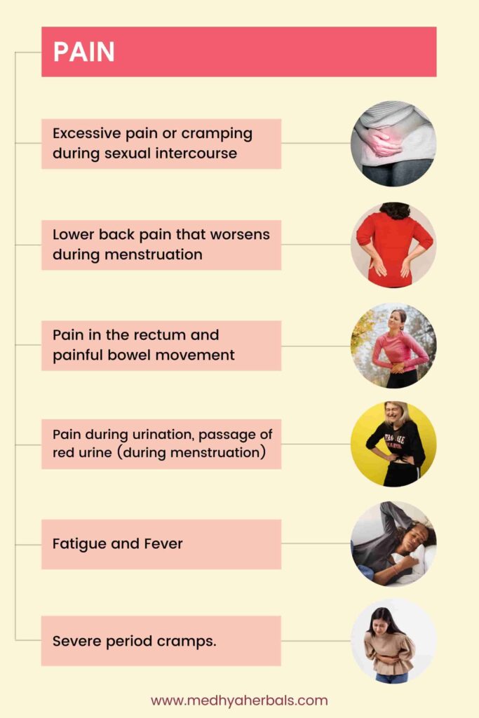 symptom of endometriosis