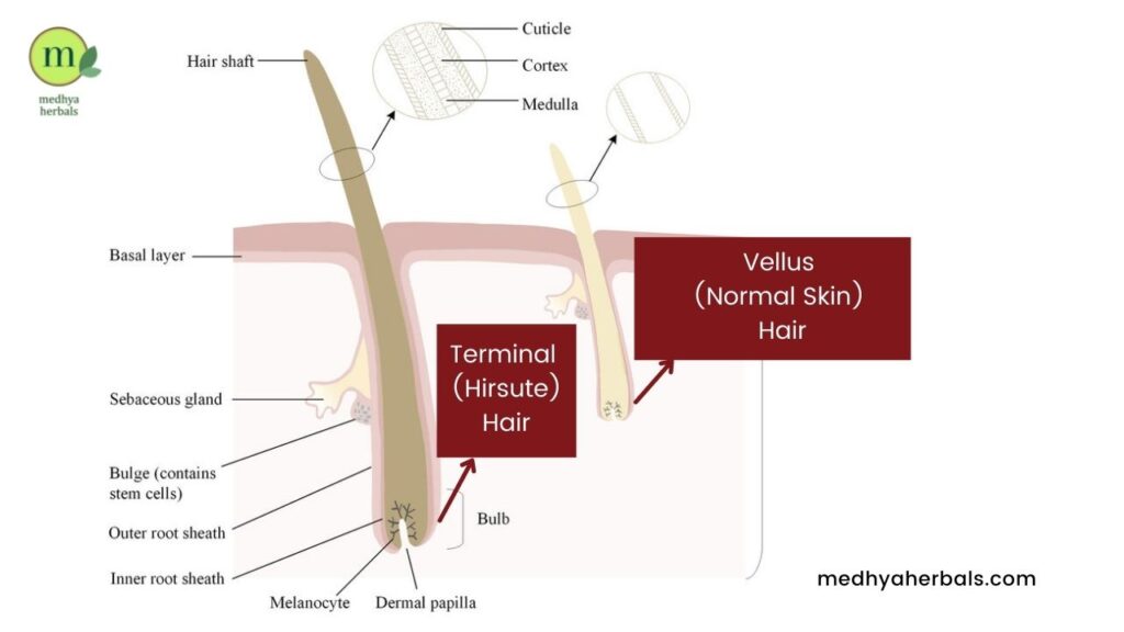 Facial Hair - Types of Hair - Vellus Hair Terminal Hair