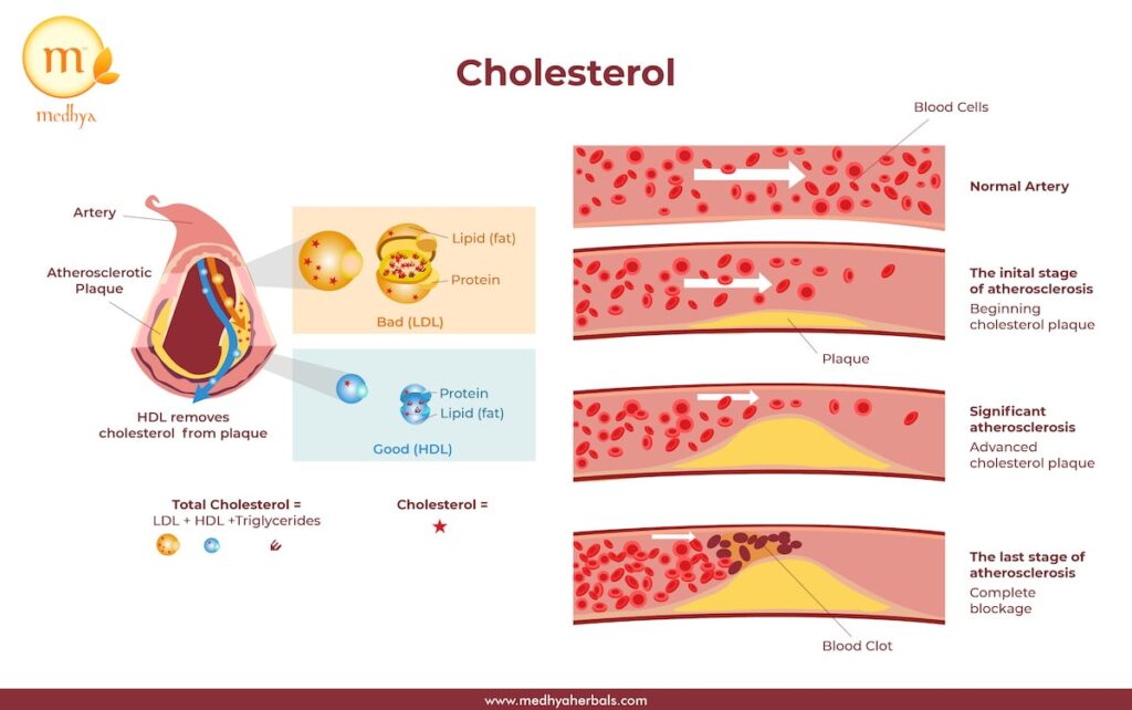 How to Lower Cholesterol Naturally-min