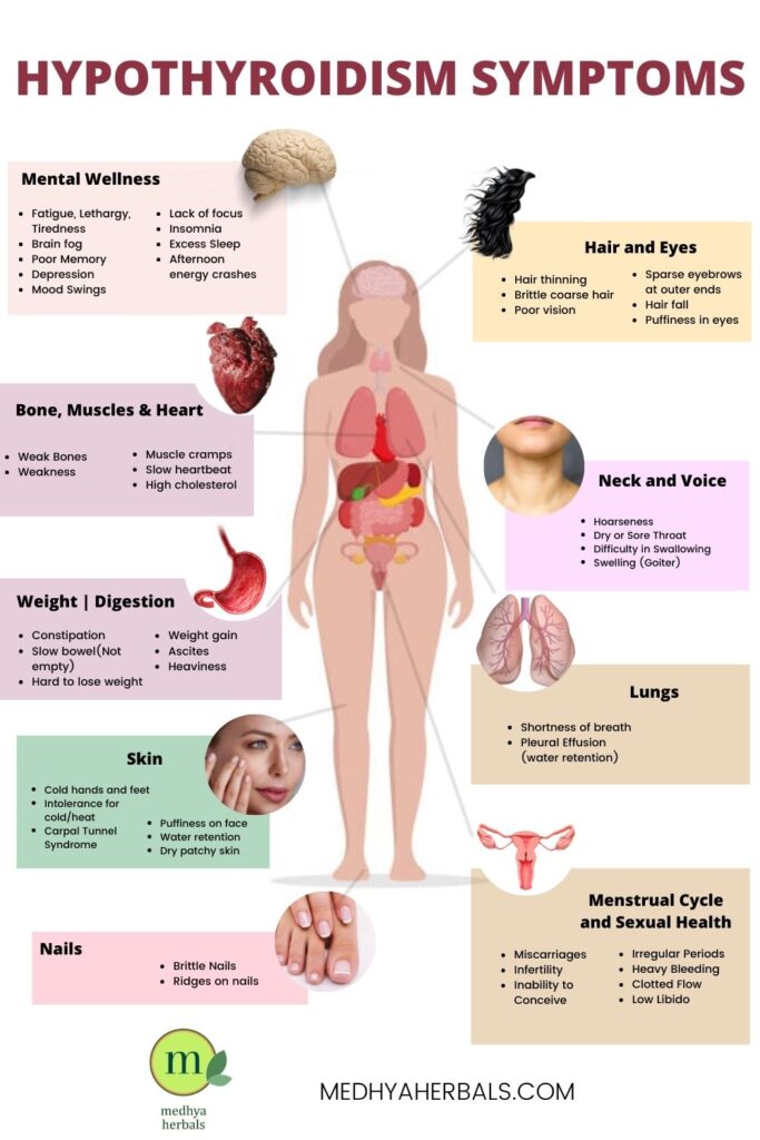 Can Hypothyroidism Cause Weakness In Legs