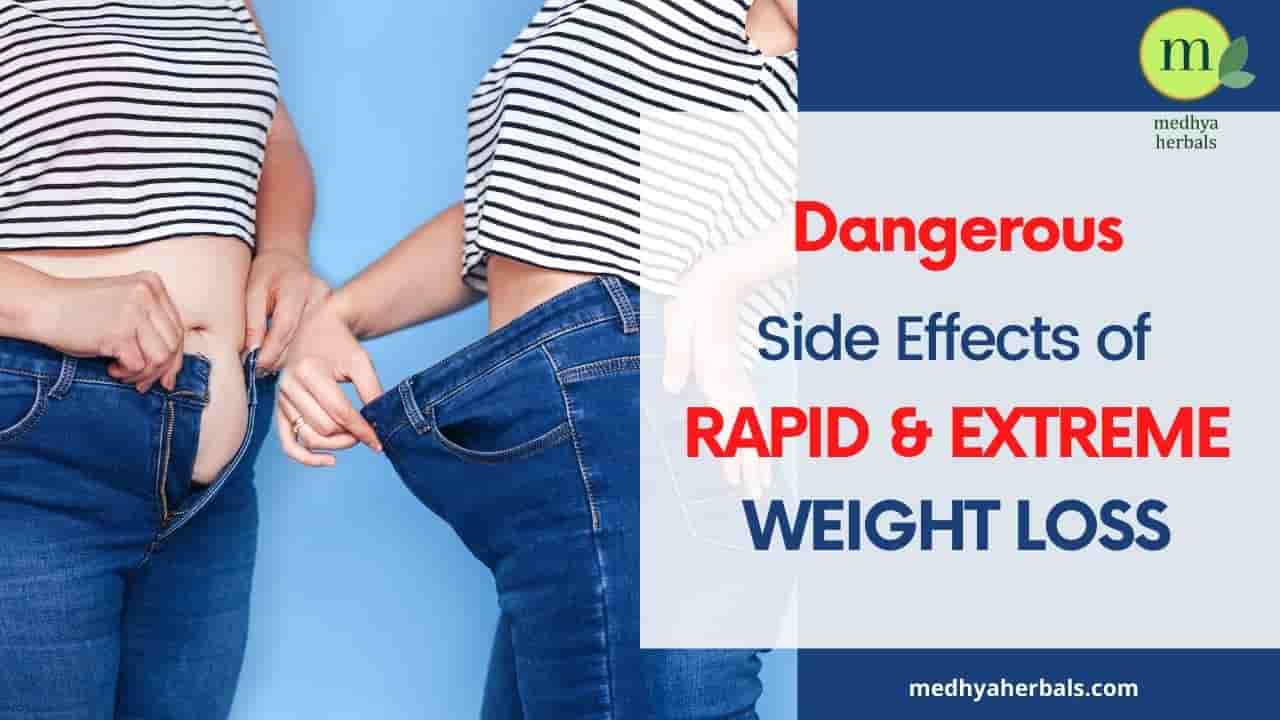 Side Effects of Rapid Weight Loss-min