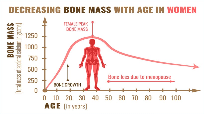 Bone Loss in Women - Menopausal Osteoporosis-min