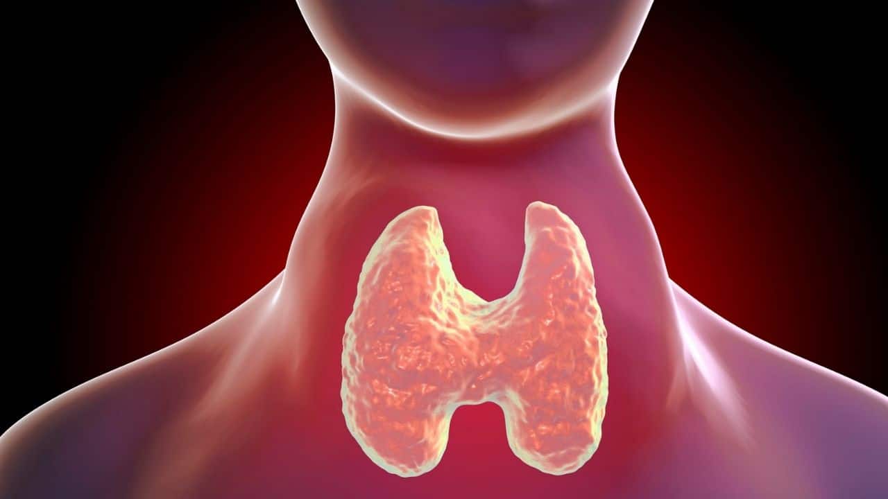 Thyroid Inflammation, Hashimoto's Thyroiditis
