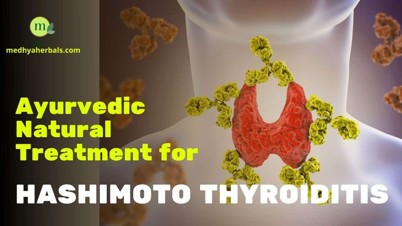 Hashimoto Thyroiditis Ayurvedic Natural Treatment-min