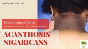 Acanthosis Nigricans- Ayurvedic Treatment for Black Neck-Dark Neck