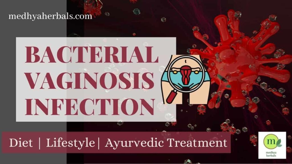 Bacterial Vaginosis Infection 