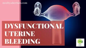 Ayurvedic Treatment for Dysfunctional Uterine Bleeding-min