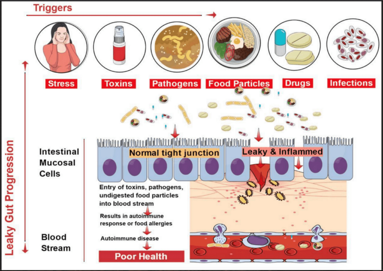 Natural Ways To Heal Gut Lining