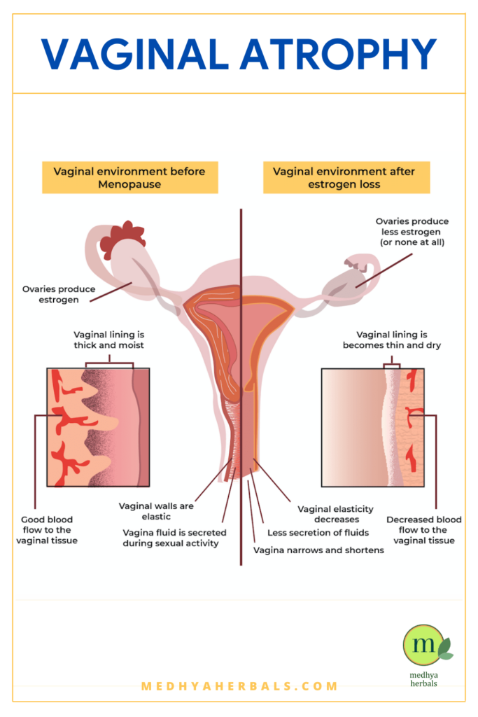 dry vaginal area