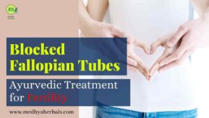 Ayurvedic Treatment for Blocked Fallopian Tubes and Fertility