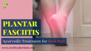 Plantar Fasciitis-Ayurvedic Treatment for Heel Pain-min