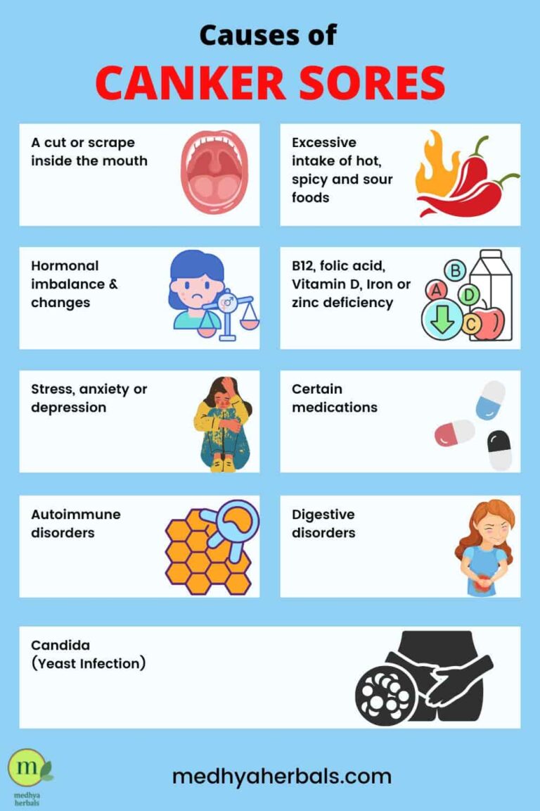 The Best Remedies to Cure Mouth Ulcers (Canker Sore) Fast