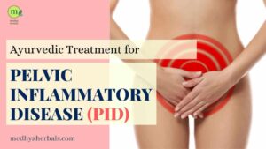 Pelvic Inflammatory Disease (PID) Ayurvedic Treatment-min