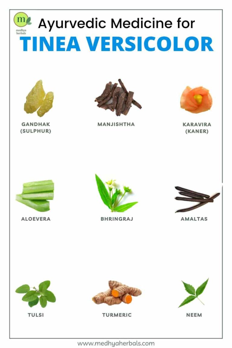 Tinea Versicolor Complete Ayurvedic Treatment that will Cure Fast