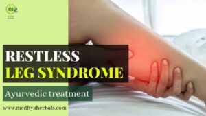 Ayurvedic Treatment Restless Leg Syndrome-min