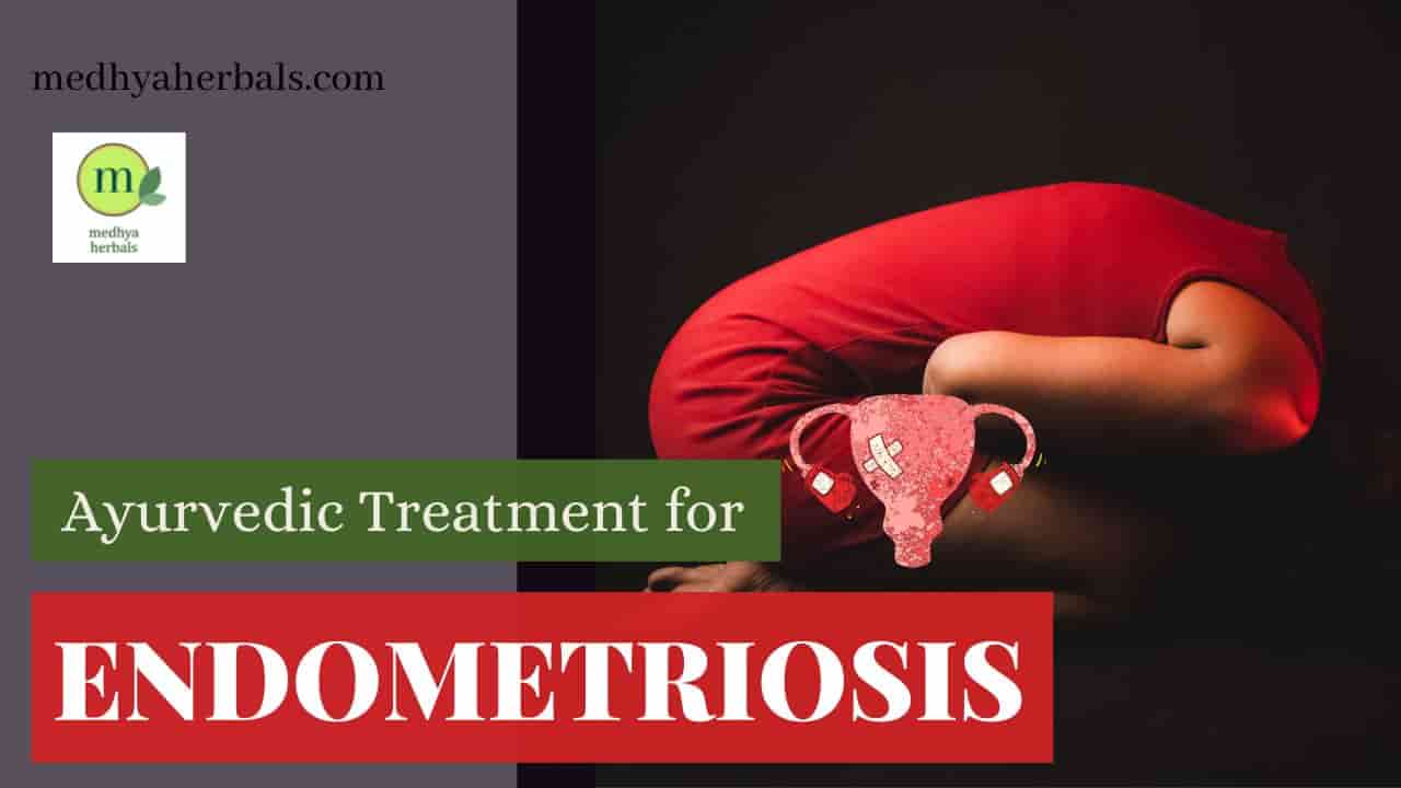 Ayurvedic Treatment for Endometriosis-min