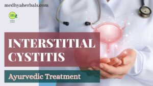 Ayurvedic Treatment for Interstitial Cystitis-min