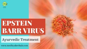 Epstein Barr Virus Ayurvedic Treatment-min(1)