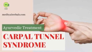Carpal Tunnel Syndrome Treatment Ayurveda