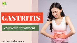 Gastritis Ayurvedic Treatment Remedies-min