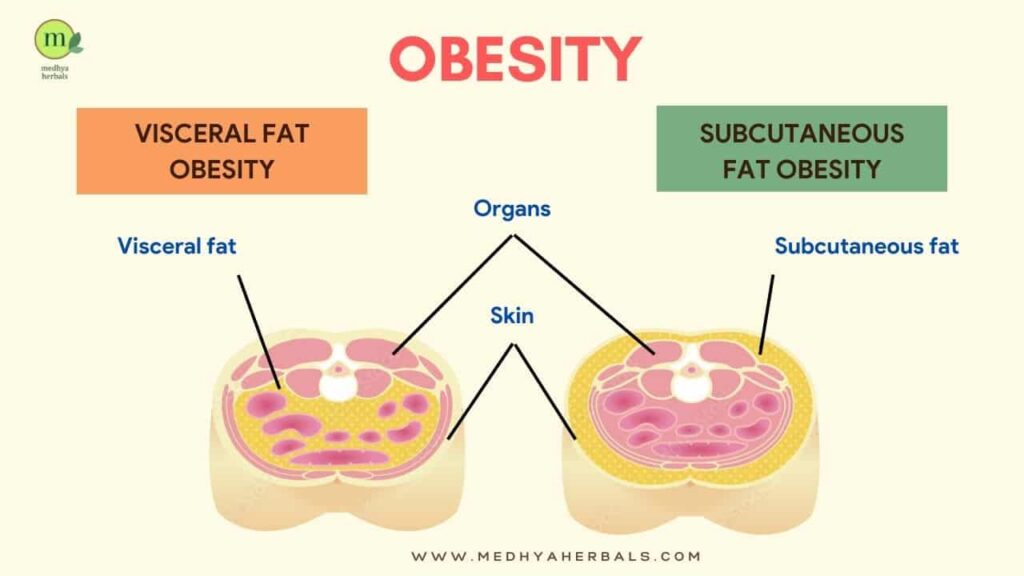 Obesity Subcutaneous Fat Vs Visceral Fat