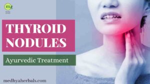 Reduce Thyroid Nodules Ayurvedic Treatment Natural-min(1)