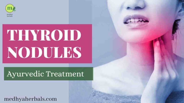 Complete Ayurvedic Treatment to Shrink Thyroid Nodules Naturally