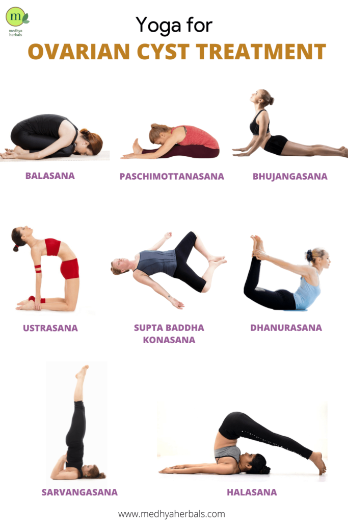 Yoga for Ovarian Cyst Treatment-min