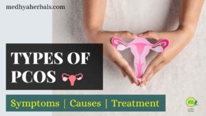 Types of PCOS Symptoms-min