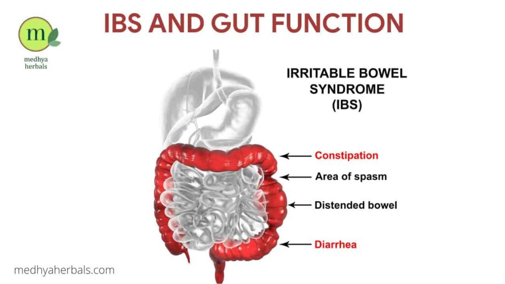 Irritable Bowel Syndrome IBS Ayurvedic Treatment-min