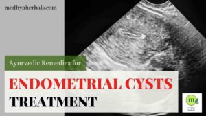 Endometrial Cyst Treatment Ayurveda-min
