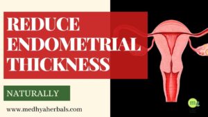 How to Reduce Endometrial Thickness Naturally-min