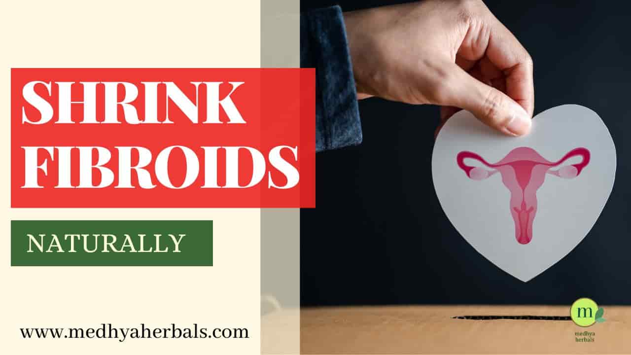 How to Shrink Uterine Fibroids Naturally-min