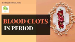 Blood Clots in Period Treatment Ayurvedic Natural Remedies-min