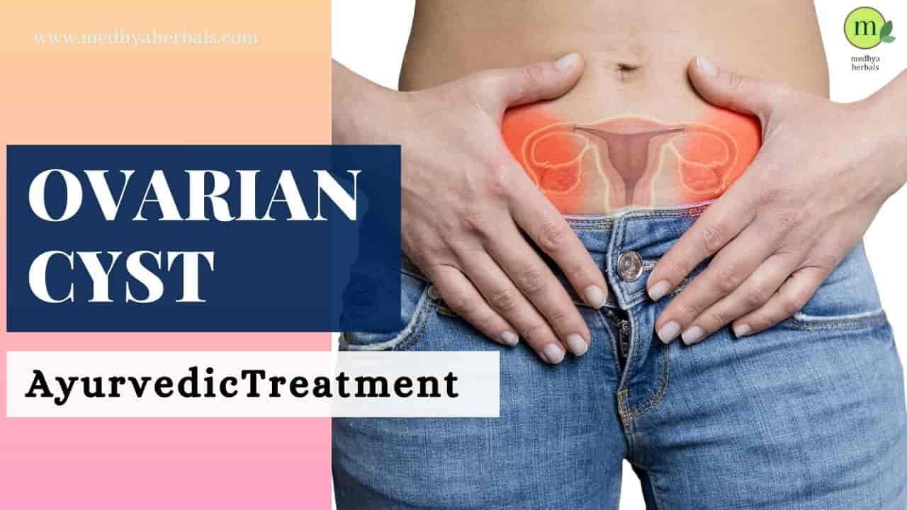 Ovarian Cyst Ayurvedic Treatment